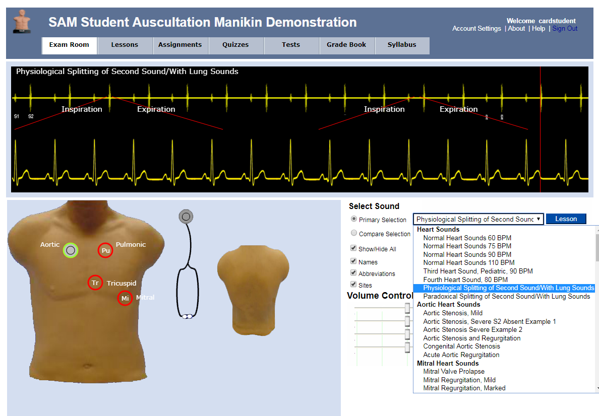 Auscultation - SAM Online - 3B Cardionics